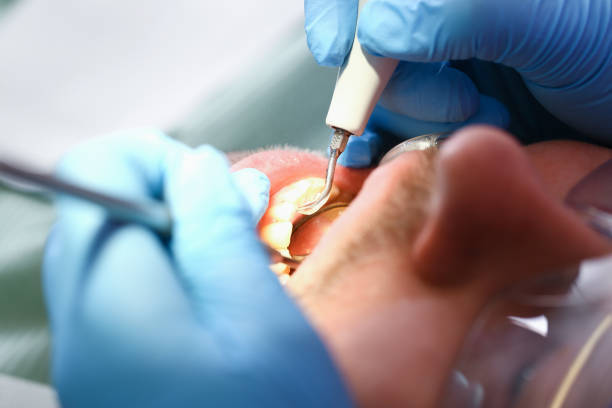 Best Emergency Dental Services Near Me  in Fairmount Heights, MD