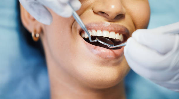 Best Dentist for Tooth Abscess  in Fairmount Heights, MD